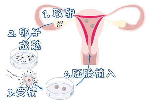 42岁二胎妈妈